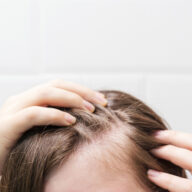Quand faire une greffe de cheveux ?