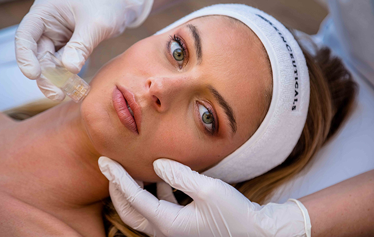 Microneedling Leman Aesthetic Clinic