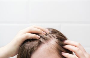 Greffe de cheveux quand